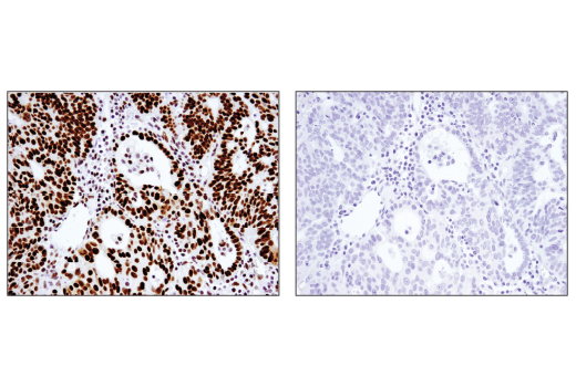 Immunohistochemistry Image 2: ARID1B/BAF250B (E1U7D) Rabbit mAb