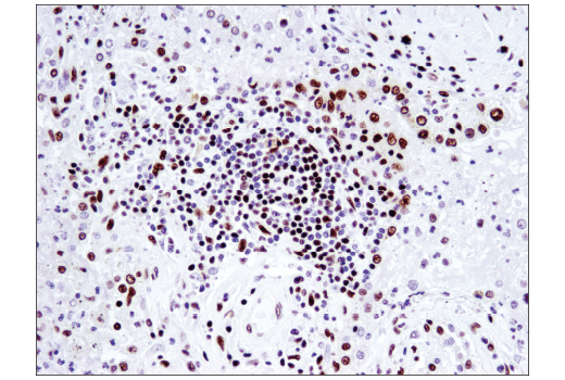  Image 49: BAF Complex IHC Antibody Sampler Kit