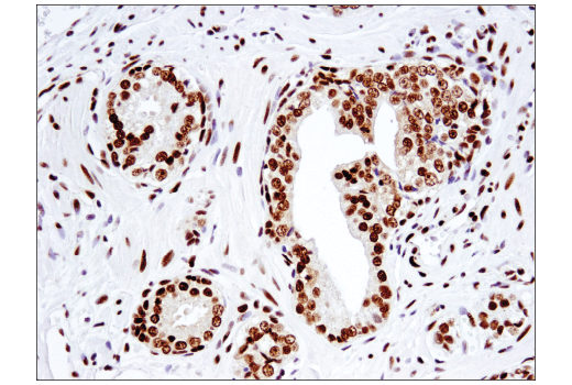 Immunohistochemistry Image 5: ARID1B/BAF250B (E1U7D) Rabbit mAb