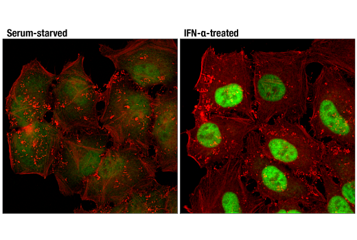 Immunofluorescence Image 1: Stat1 (D1K9Y) Rabbit mAb (BSA and Azide Free)