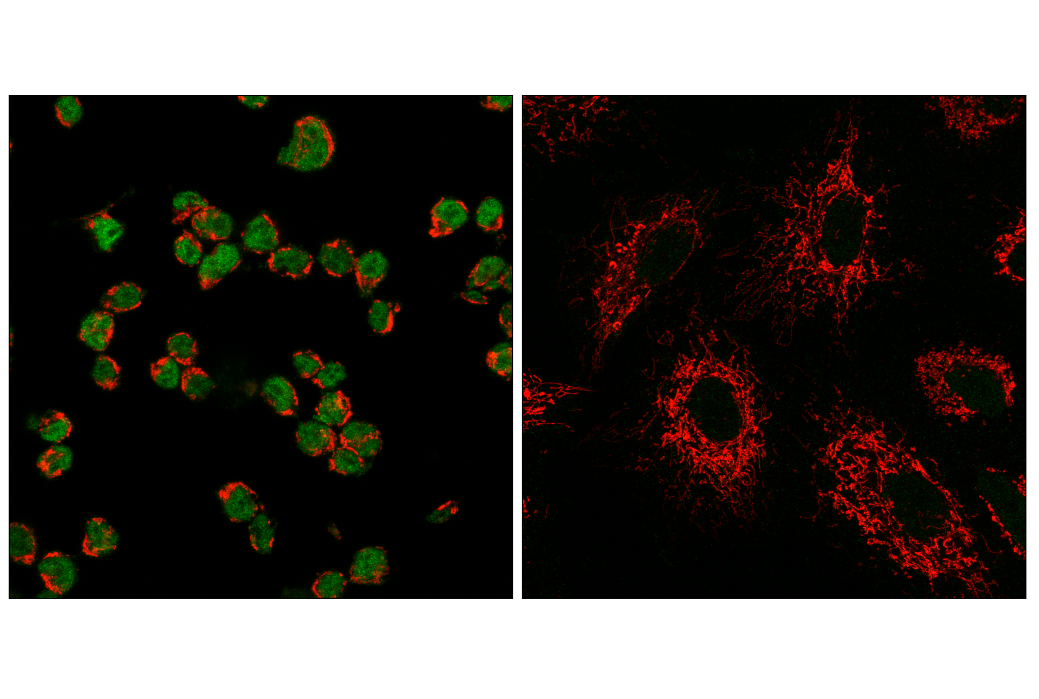 Immunofluorescence Image 1: Tox2 (E3N3G) Rabbit mAb (Alexa Fluor® 488 Conjugate)