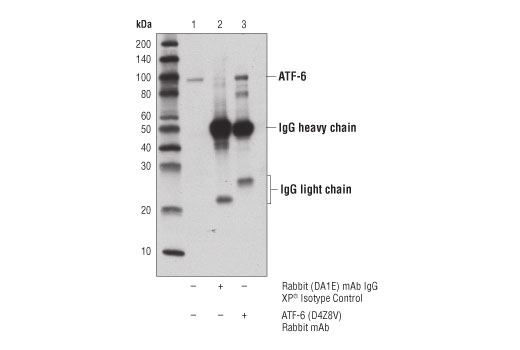  Image 20: ER Homeostasis Antibody Sampler Kit