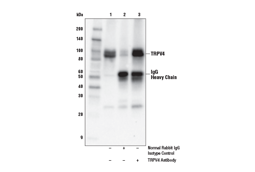 Immunoprecipitation Image 1: TRPV4 Antibody