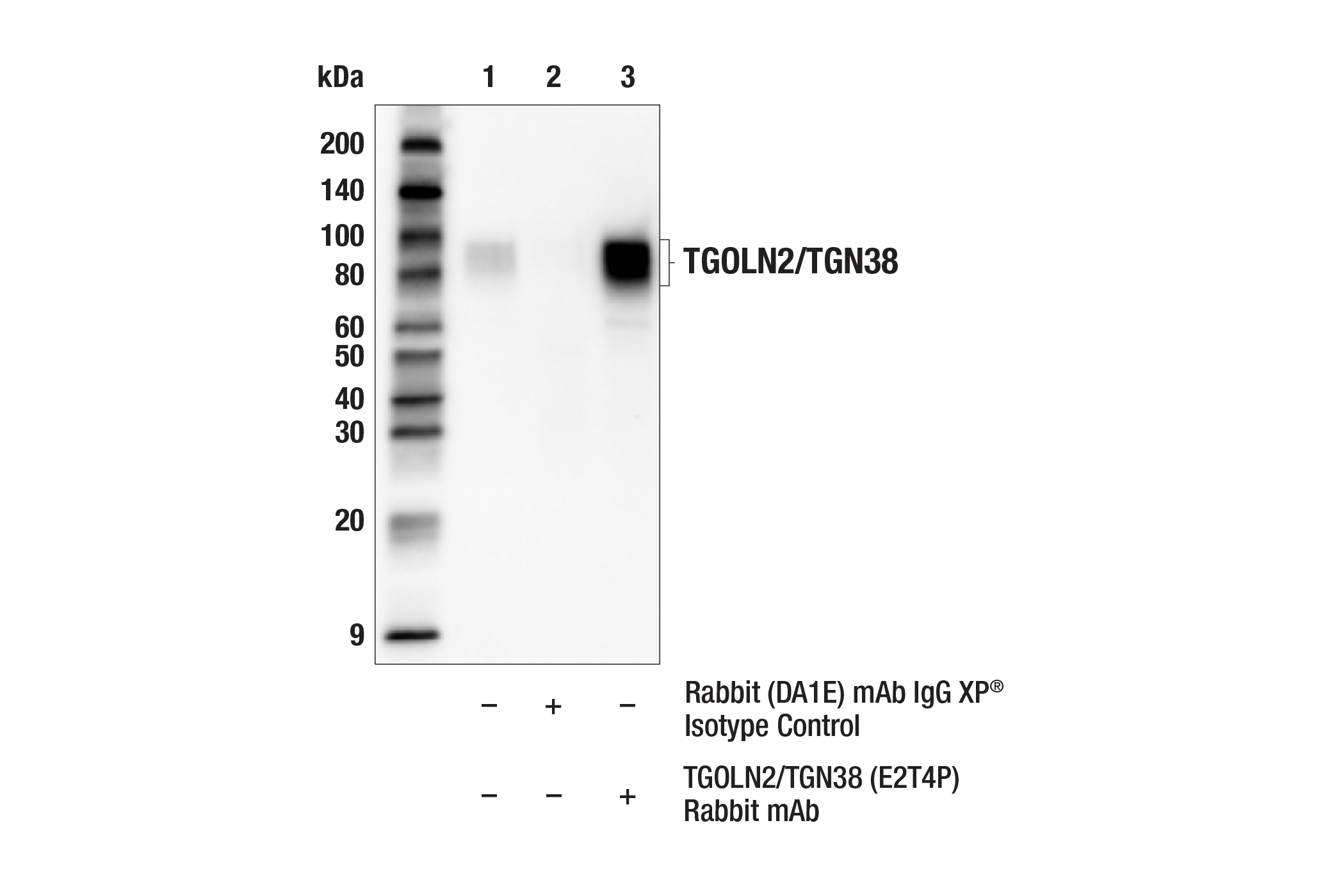 Immunoprecipitation Image 1: TGOLN2/TGN38 (E2T4P) Rabbit mAb