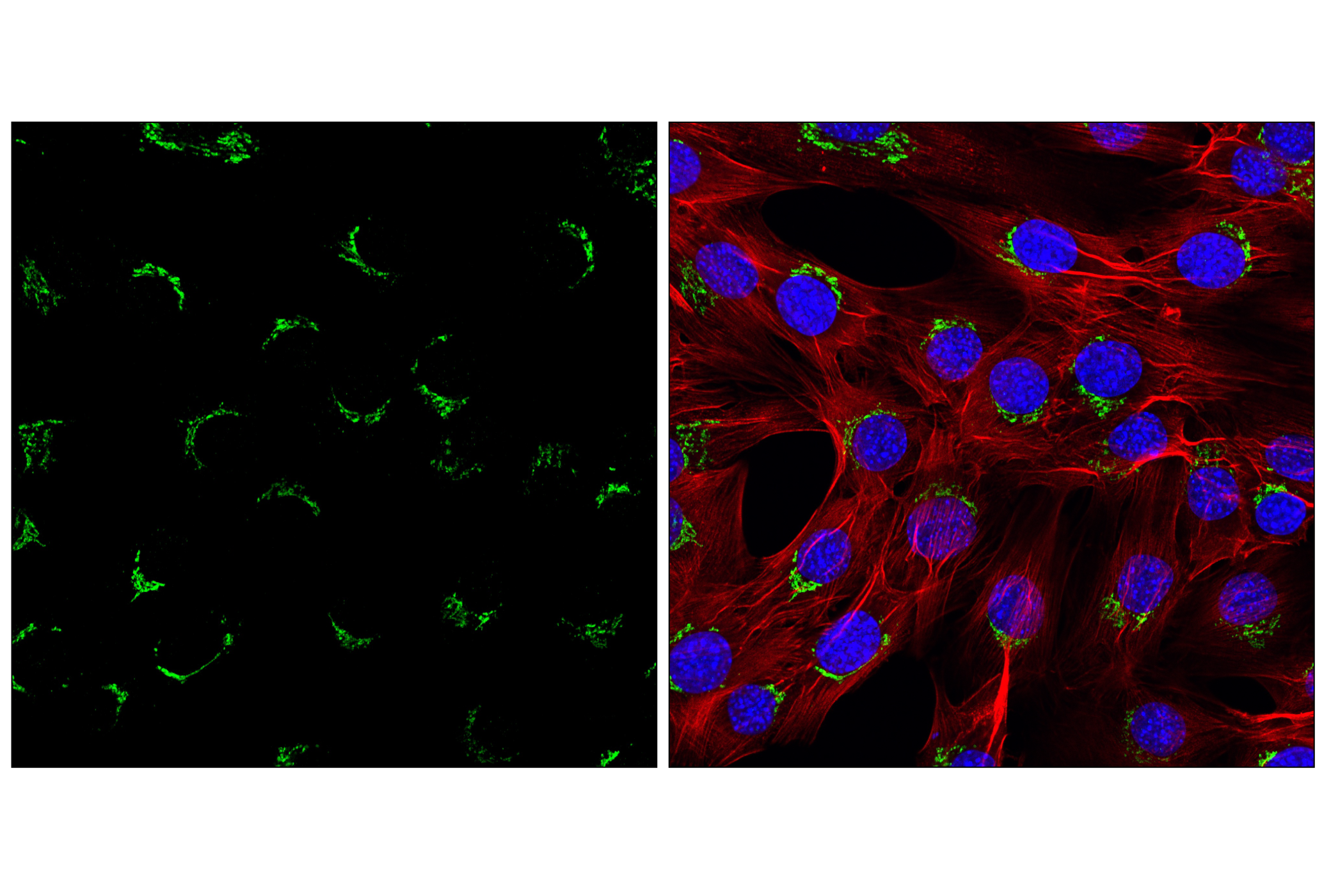 Immunofluorescence Image 2: TGOLN2/TGN38 (E2T4P) Rabbit mAb