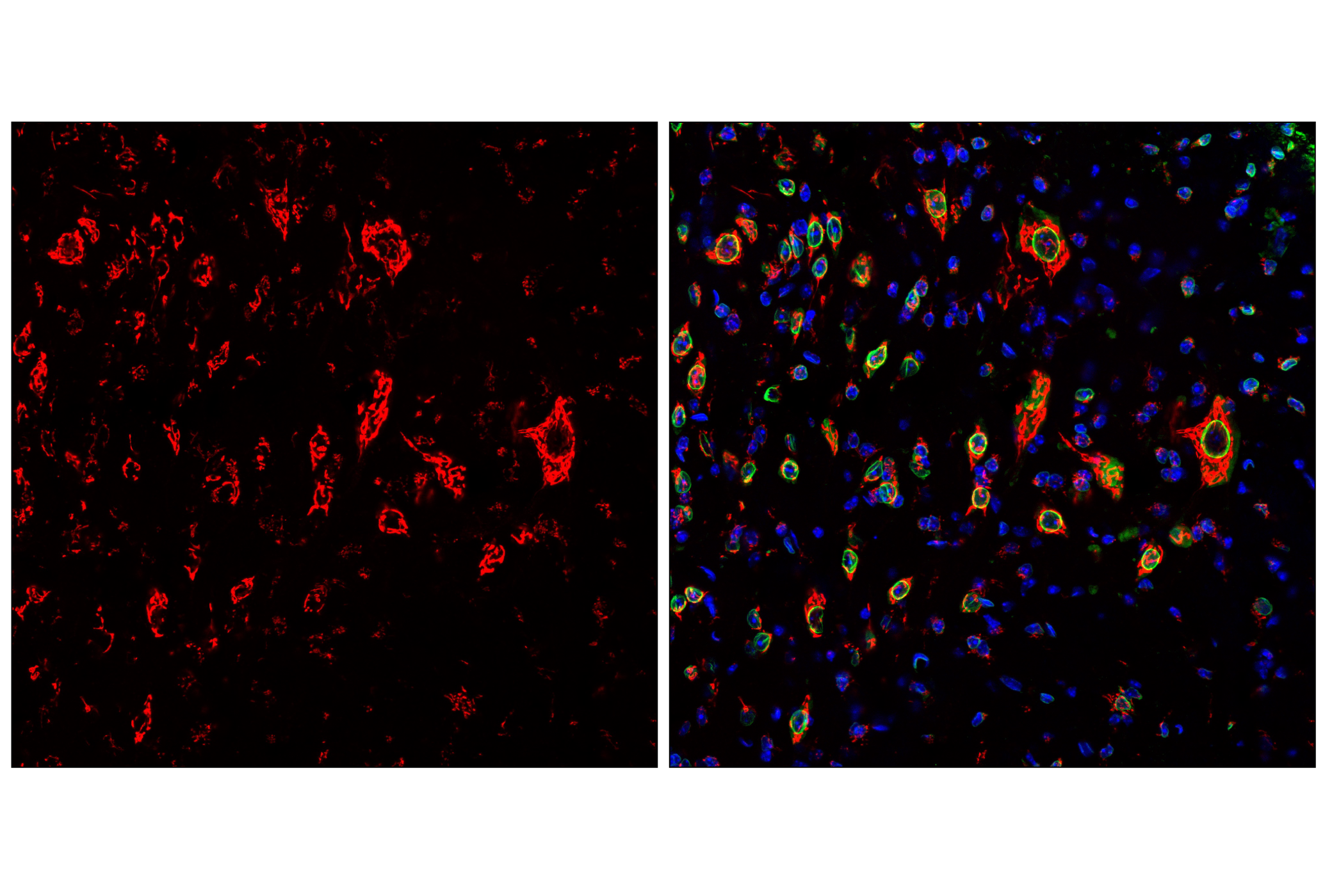 Immunofluorescence Image 1: TGOLN2/TGN38 (E2T4P) Rabbit mAb