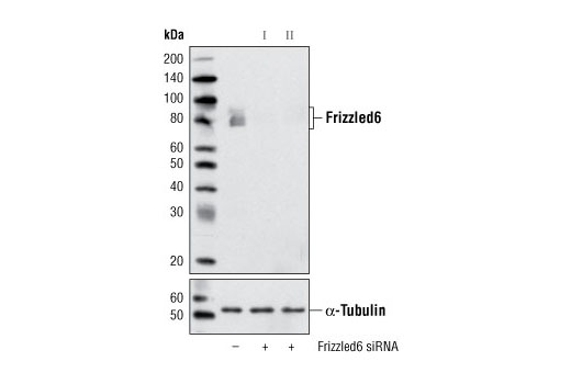  Image 1: SignalSilence® Frizzled6 siRNA II