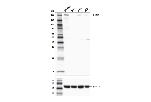  Image 1: PhosphoPlus ® GCN2 (Thr899) Antibody Duet