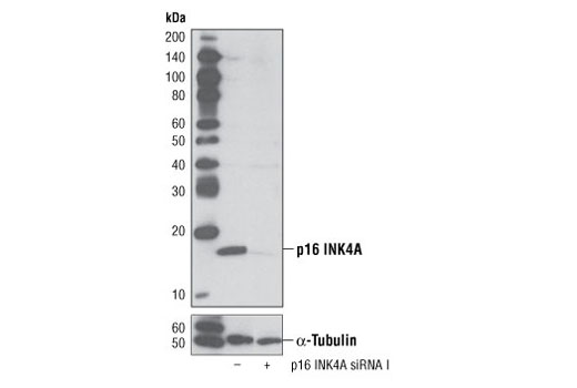  Image 1: SignalSilence® p16 INK4A siRNA I