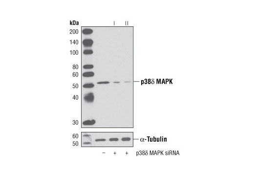  Image 1: SignalSilence® p38δ MAPK siRNA II