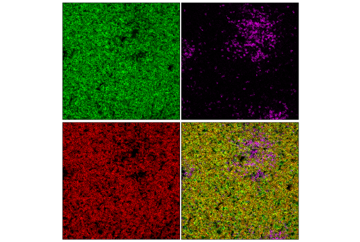 Immunofluorescence Image 2: CD96 (E1Y2Z) Rabbit mAb