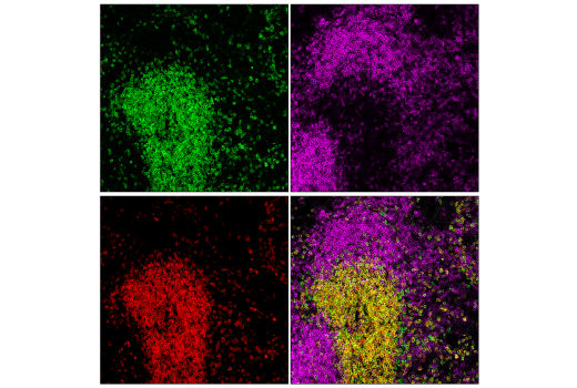 Immunofluorescence Image 1: CD96 (E1Y2Z) Rabbit mAb