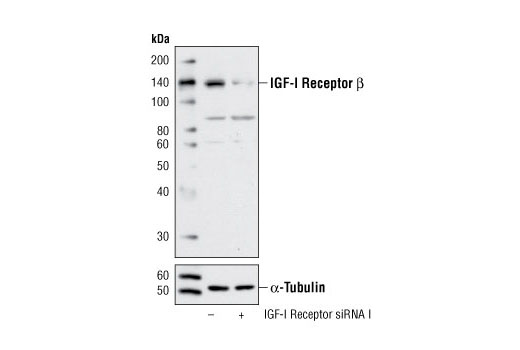  Image 1: SignalSilence® IGF-I Receptor siRNA I