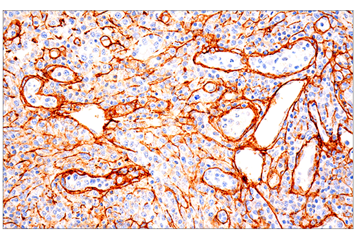 Immunohistochemistry Image 1: COL1A1 (E3E1X) Mouse mAb (BSA and Azide Free)