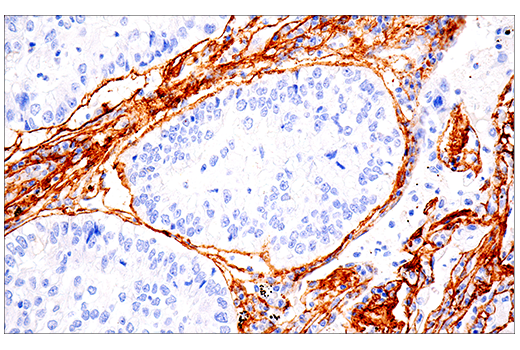 Immunohistochemistry Image 3: COL1A1 (E3E1X) Mouse mAb (BSA and Azide Free)