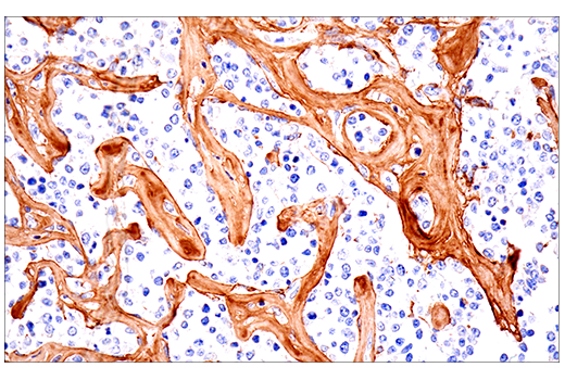 Immunohistochemistry Image 7: COL1A1 (E3E1X) Mouse mAb (BSA and Azide Free)