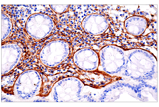 Immunohistochemistry Image 8: COL1A1 (E3E1X) Mouse mAb (BSA and Azide Free)