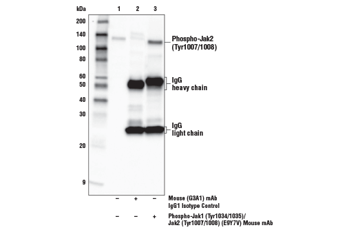 Immunoprecipitation Image 1: Phospho-Jak1 (Tyr1034/1035)/Jak2 (Tyr1007/1008) (E9Y7V) Mouse mAb