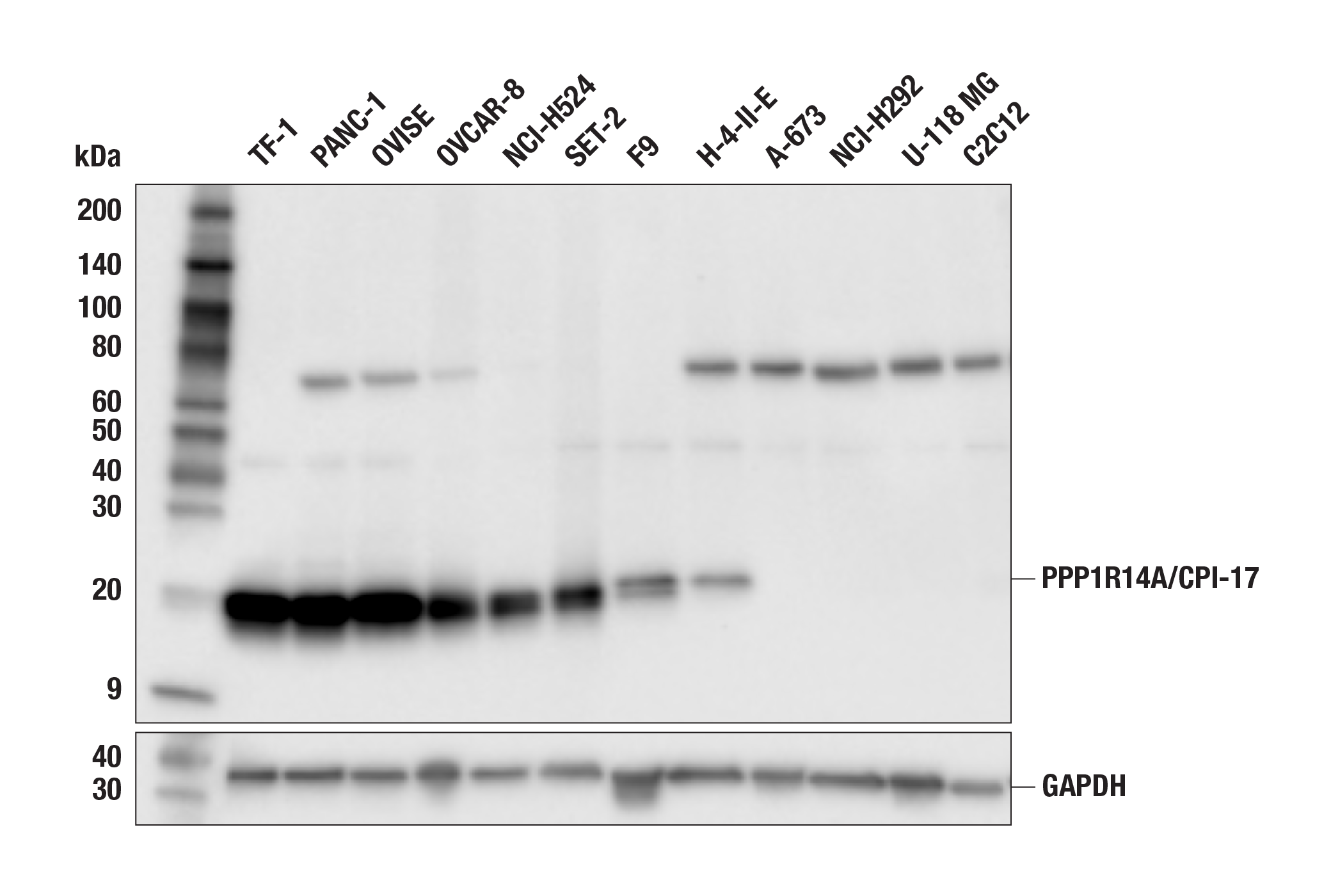 Western Blotting Image 2: PPP1R14A/CPI-17 (F1I6X) Rabbit Monoclonal Antibody
