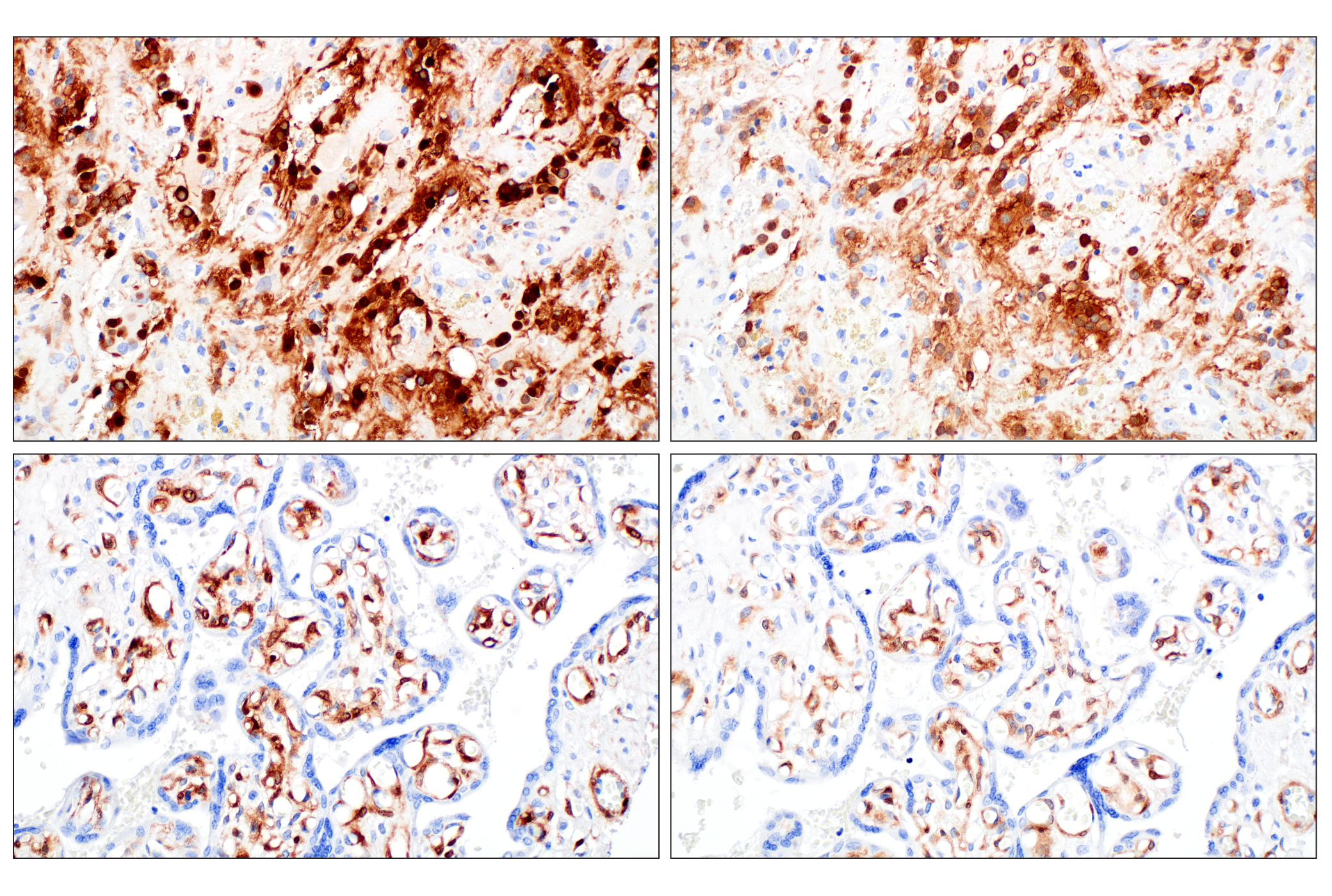 Immunohistochemistry Image 20: PPP1R14A/CPI-17 (F1I6X) Rabbit Monoclonal Antibody