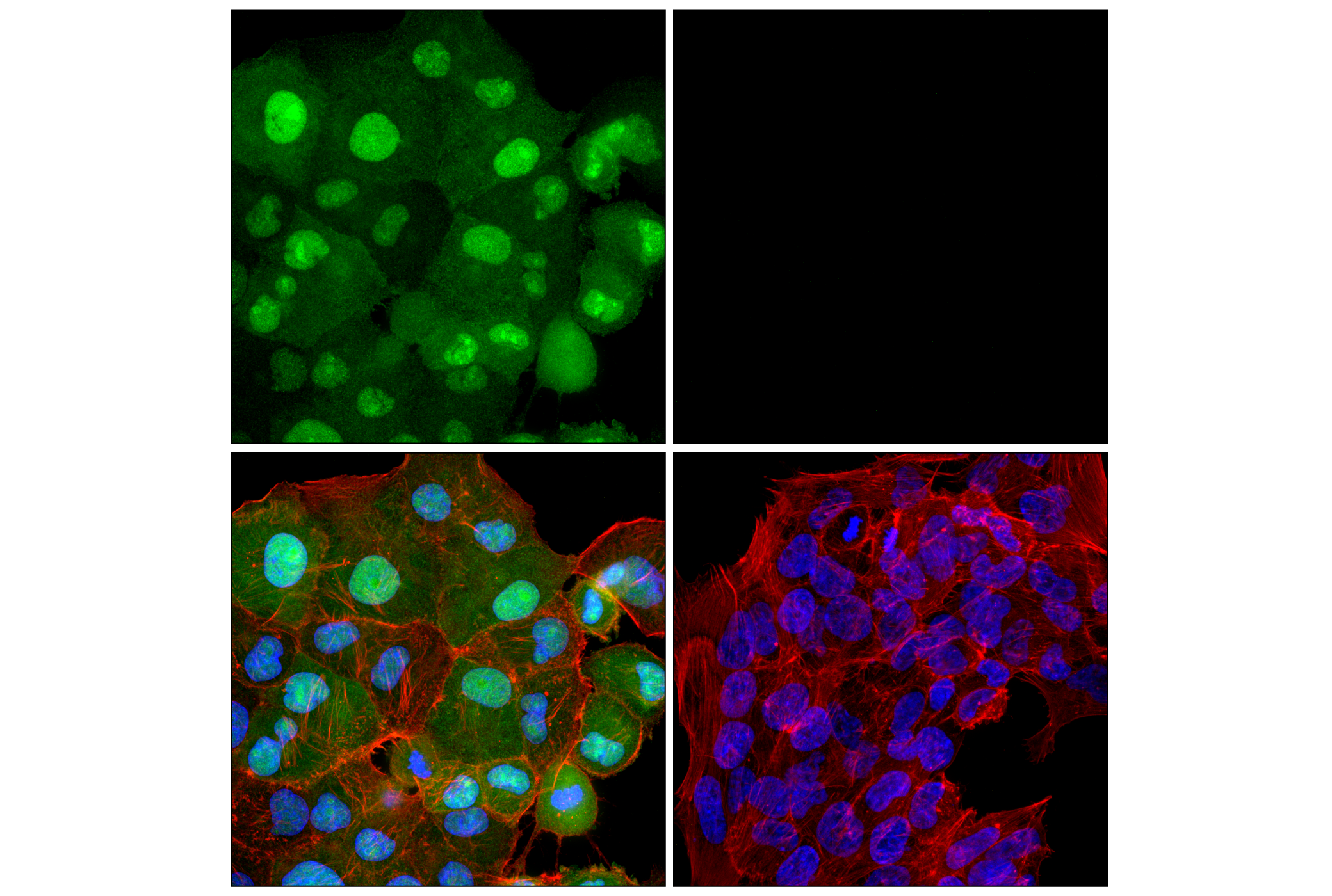 Immunofluorescence Image 1: PPP1R14A/CPI-17 (F1I6X) Rabbit Monoclonal Antibody