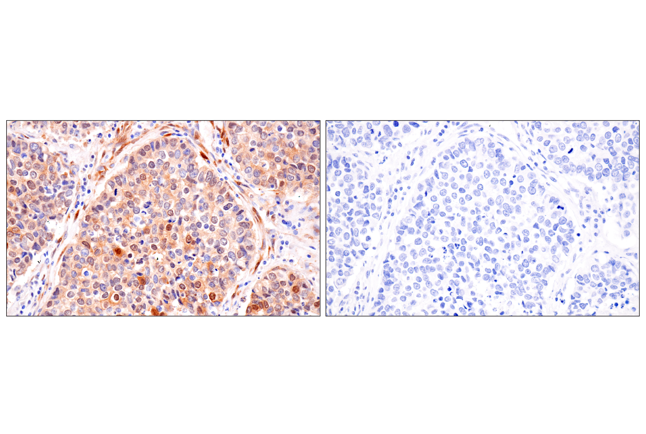 Immunohistochemistry Image 21: PPP1R14A/CPI-17 (F1I6X) Rabbit Monoclonal Antibody