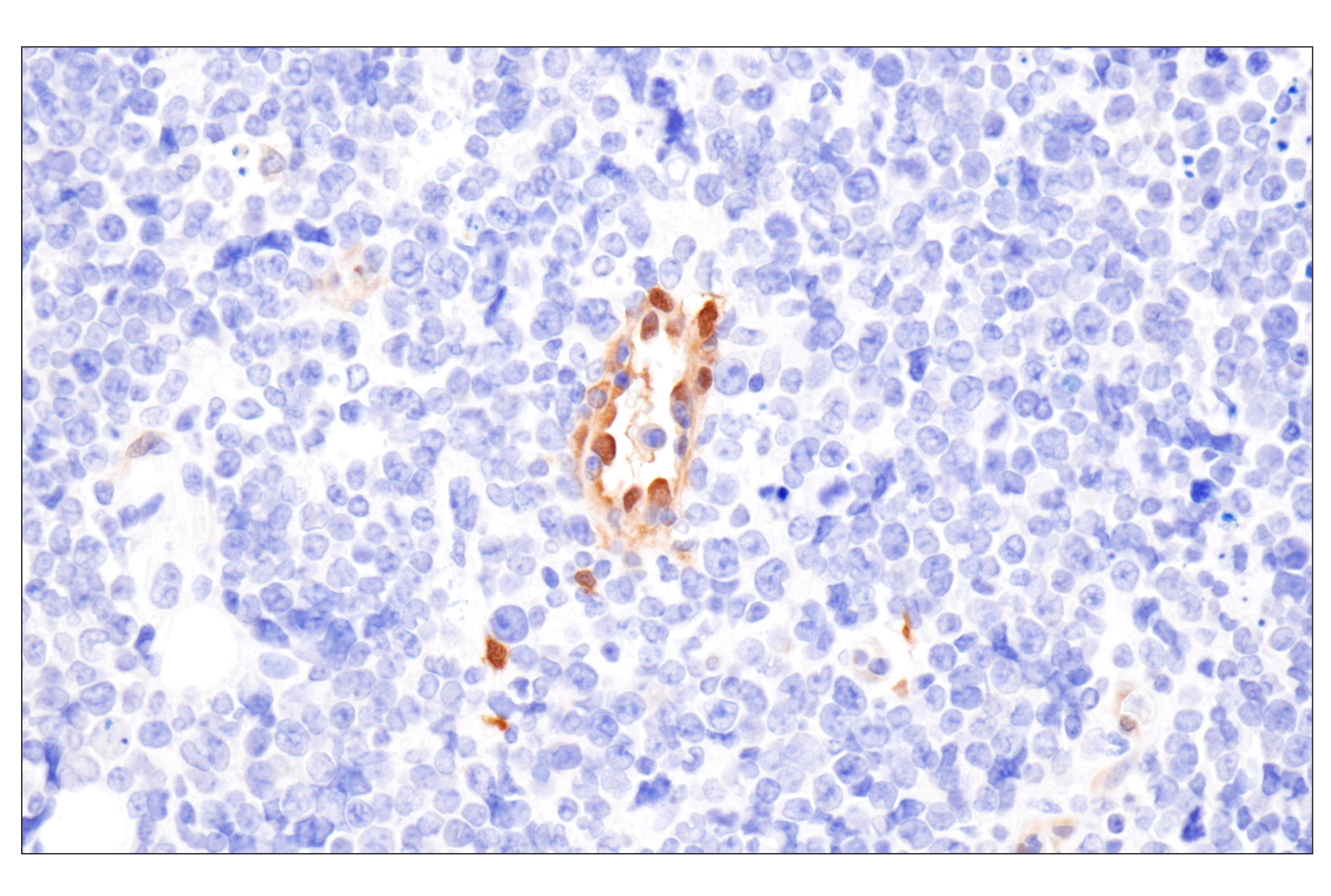 Immunohistochemistry Image 14: PPP1R14A/CPI-17 (F1I6X) Rabbit Monoclonal Antibody