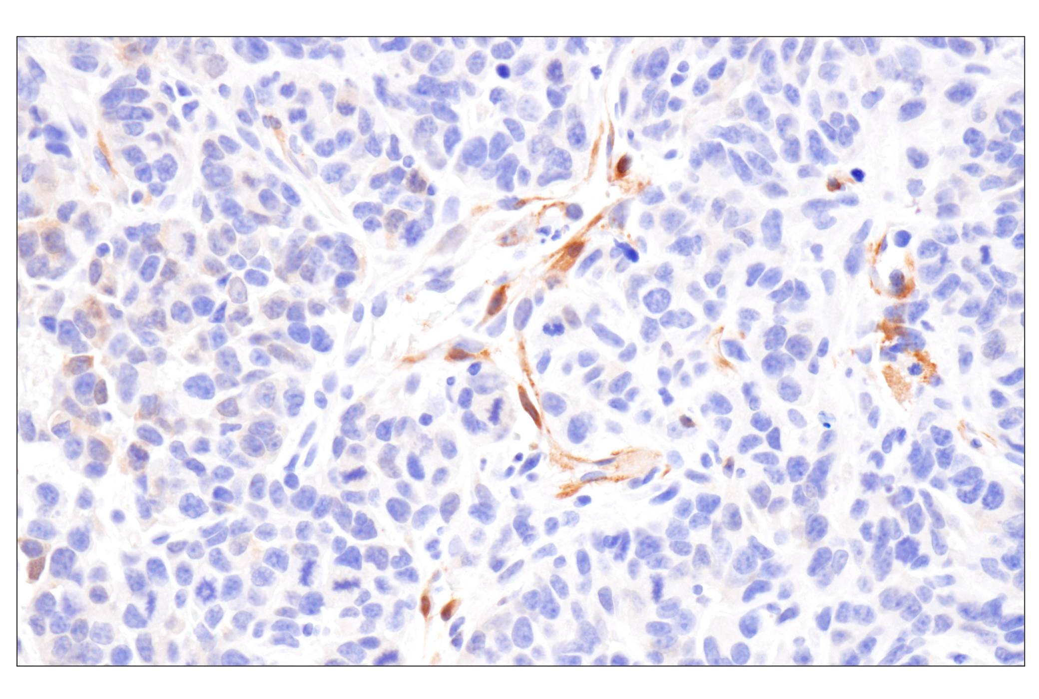 Immunohistochemistry Image 15: PPP1R14A/CPI-17 (F1I6X) Rabbit Monoclonal Antibody