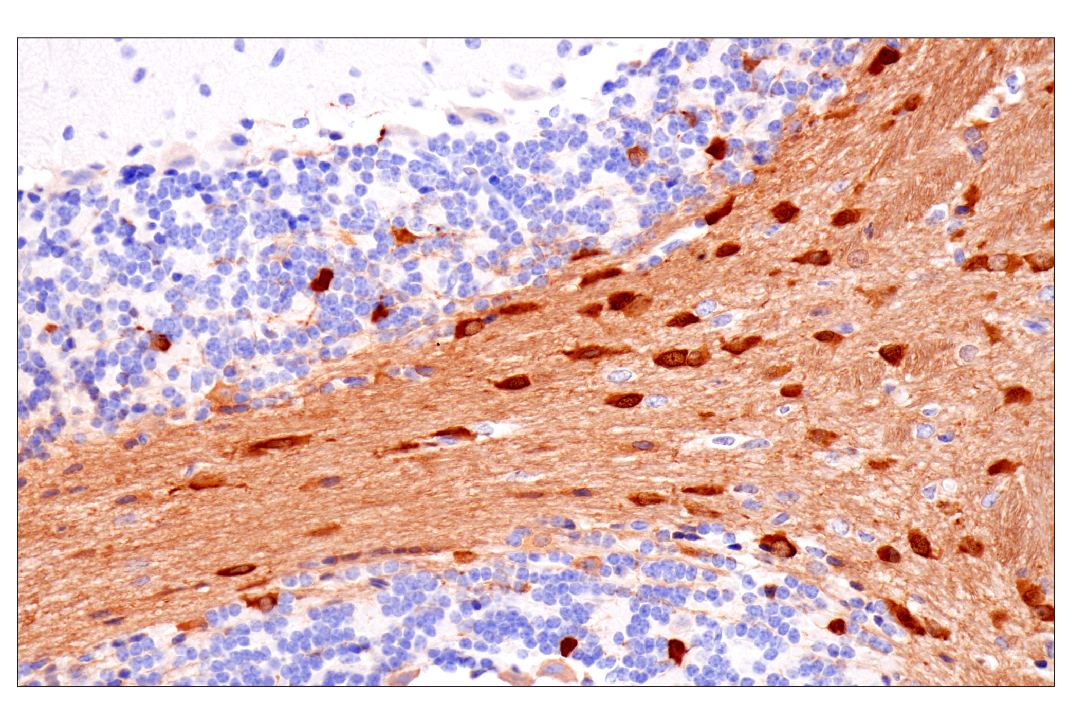 Immunohistochemistry Image 16: PPP1R14A/CPI-17 (F1I6X) Rabbit Monoclonal Antibody