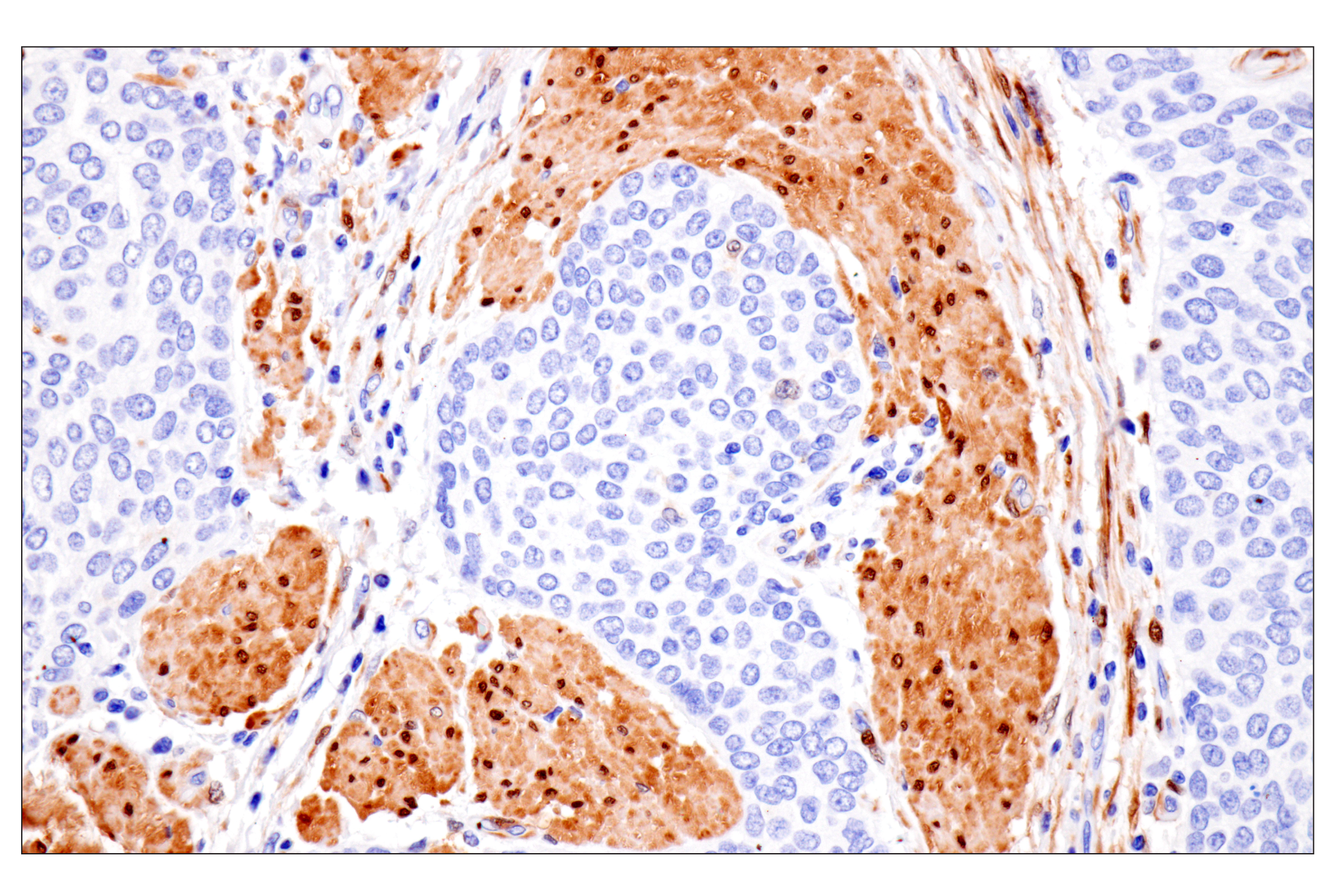 Immunohistochemistry Image 1: PPP1R14A/CPI-17 (F1I6X) Rabbit Monoclonal Antibody