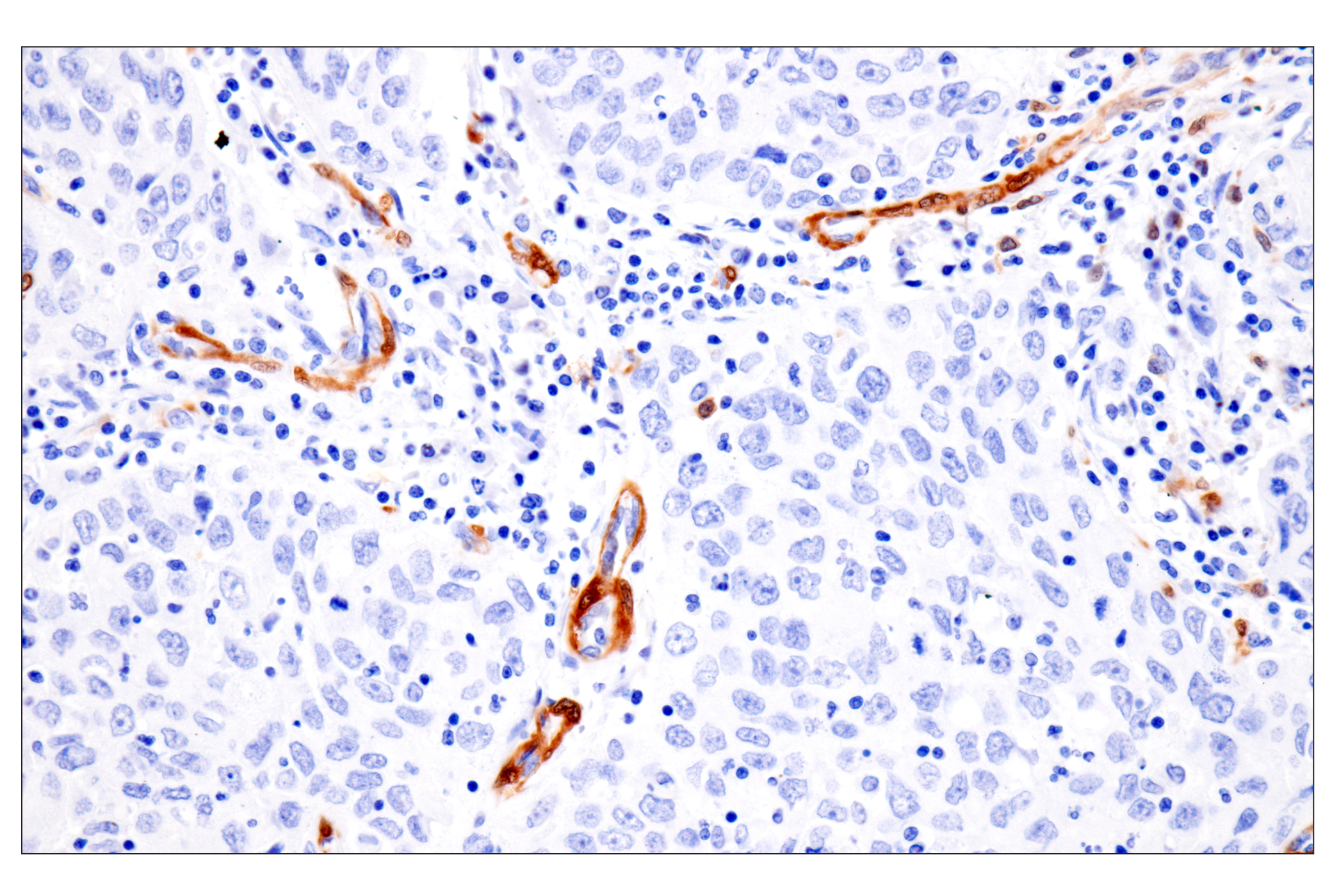 Immunohistochemistry Image 3: PPP1R14A/CPI-17 (F1I6X) Rabbit Monoclonal Antibody