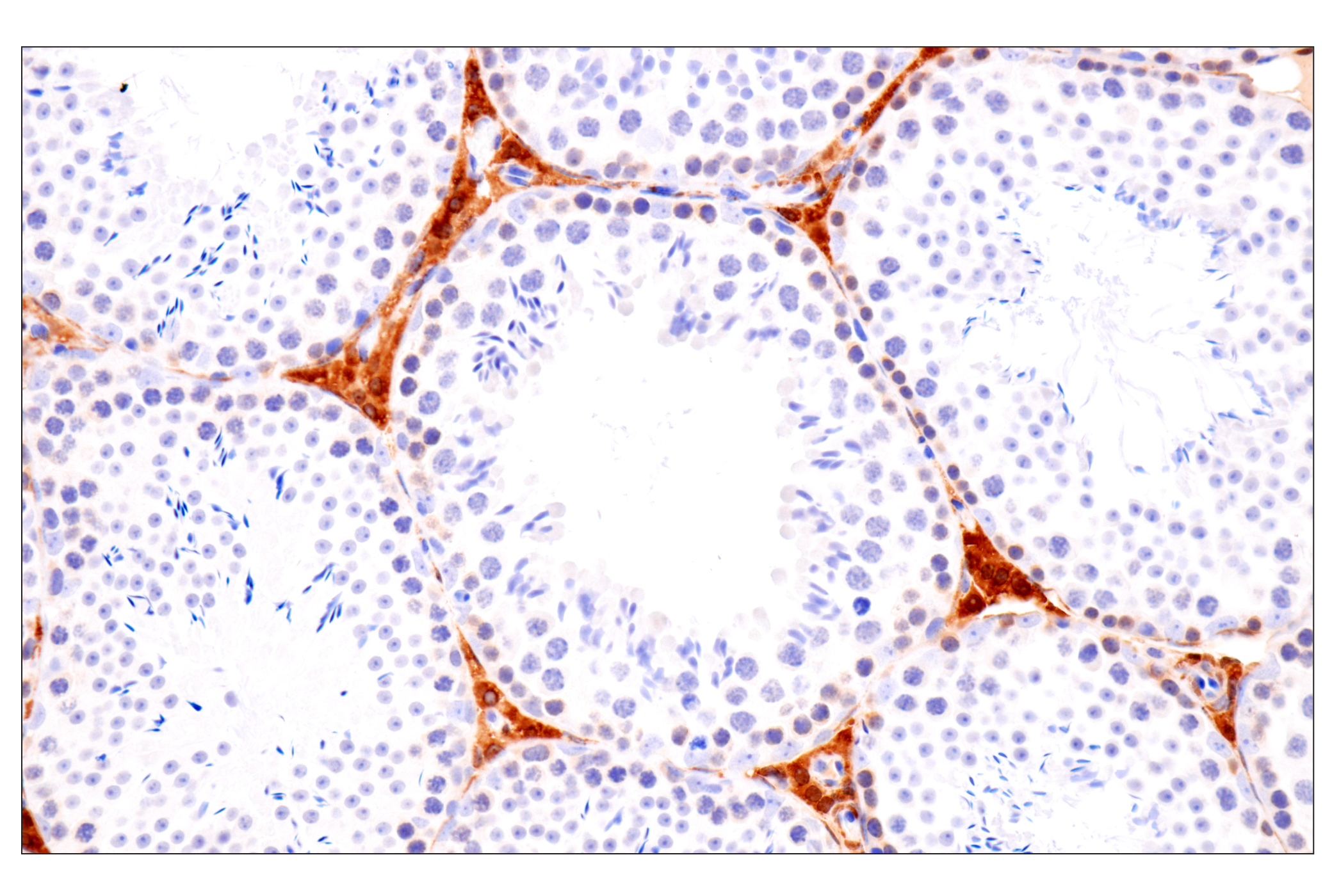 Immunohistochemistry Image 17: PPP1R14A/CPI-17 (F1I6X) Rabbit Monoclonal Antibody
