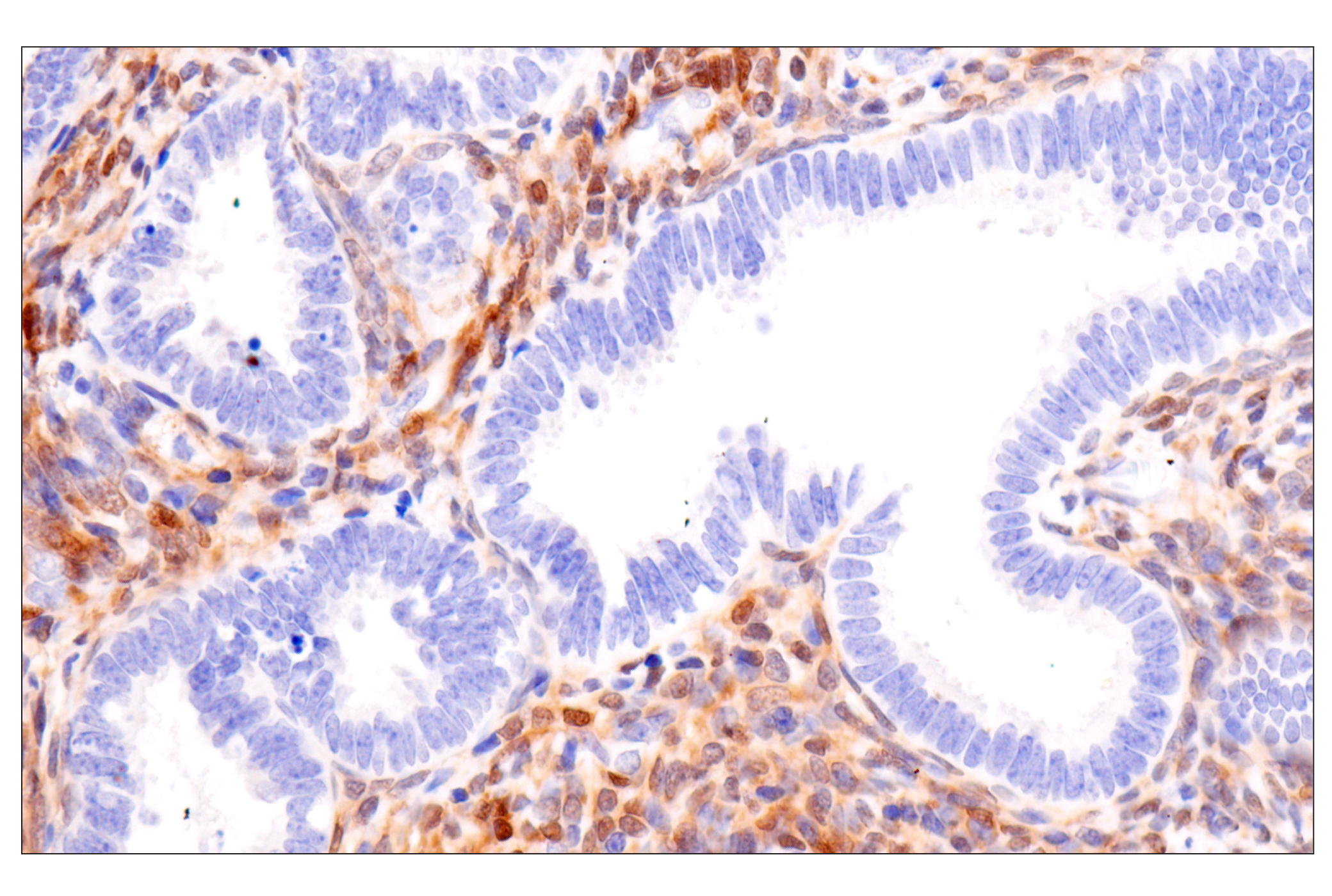 Immunohistochemistry Image 13: PPP1R14A/CPI-17 (F1I6X) Rabbit Monoclonal Antibody