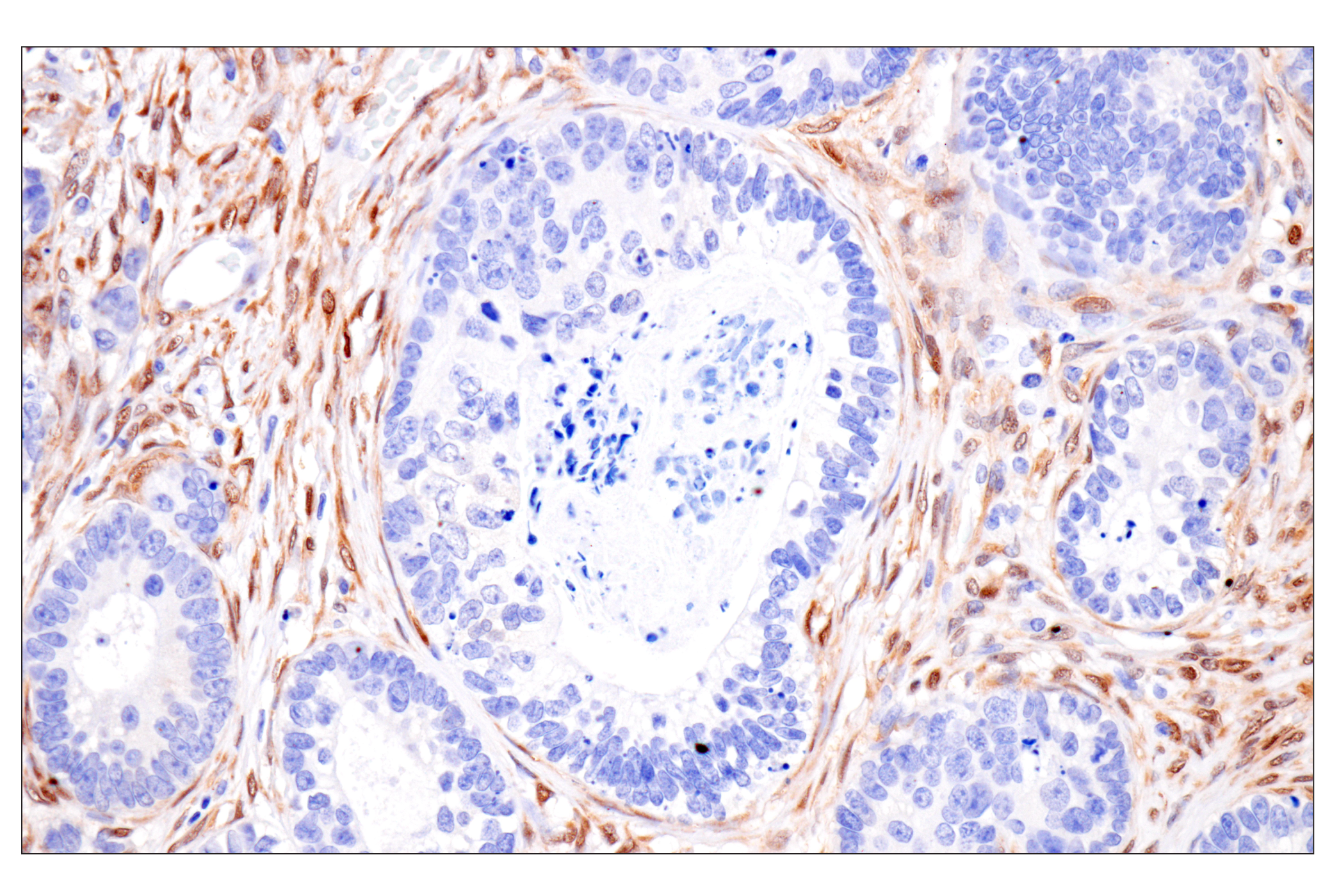 Immunohistochemistry Image 4: PPP1R14A/CPI-17 (F1I6X) Rabbit Monoclonal Antibody