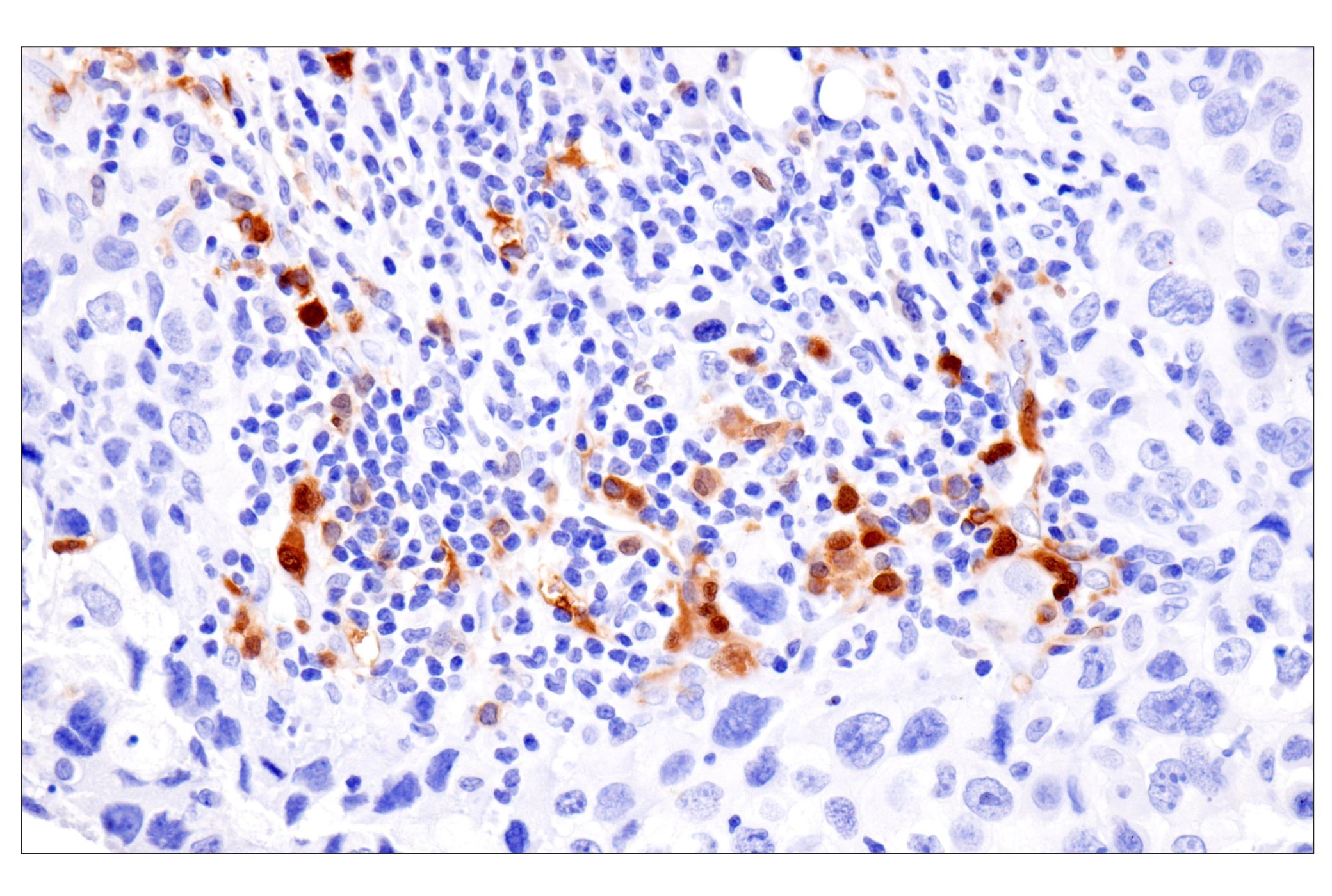 Immunohistochemistry Image 2: PPP1R14A/CPI-17 (F1I6X) Rabbit Monoclonal Antibody