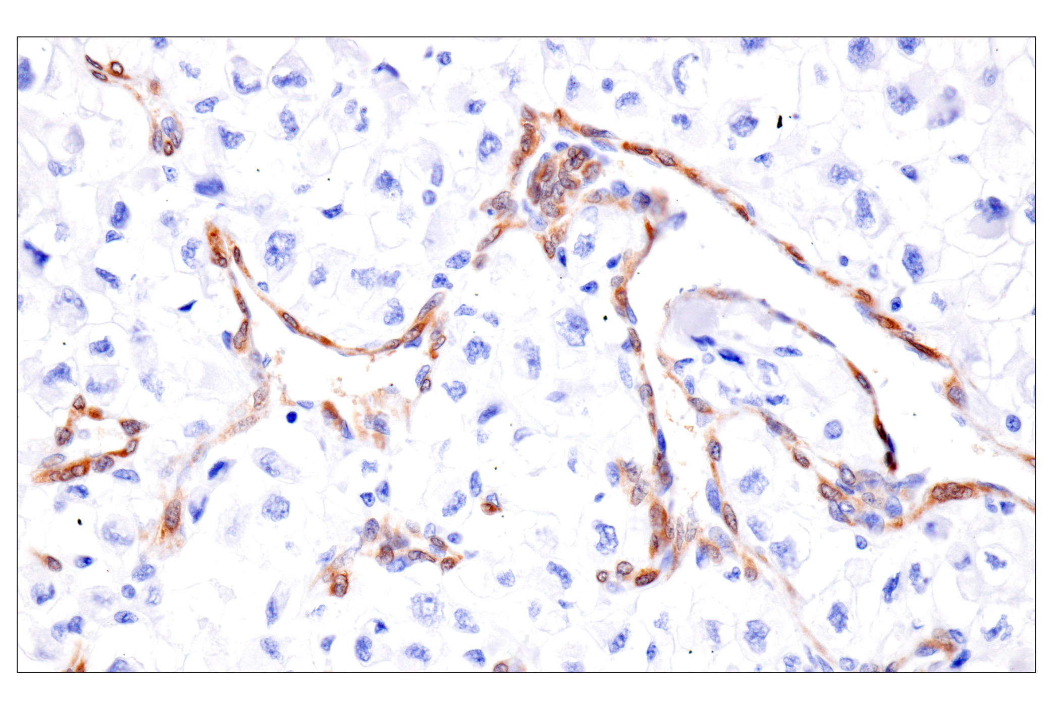 Immunohistochemistry Image 6: PPP1R14A/CPI-17 (F1I6X) Rabbit Monoclonal Antibody