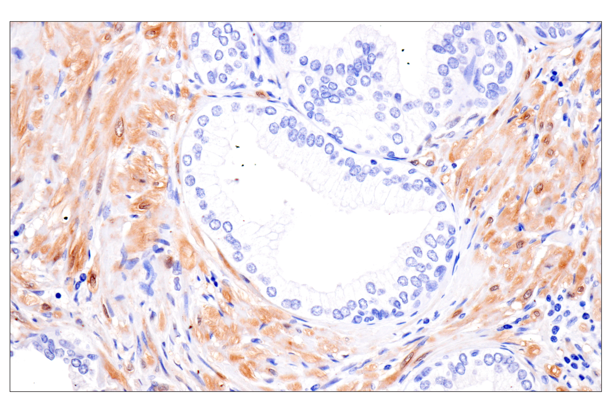 Immunohistochemistry Image 5: PPP1R14A/CPI-17 (F1I6X) Rabbit Monoclonal Antibody