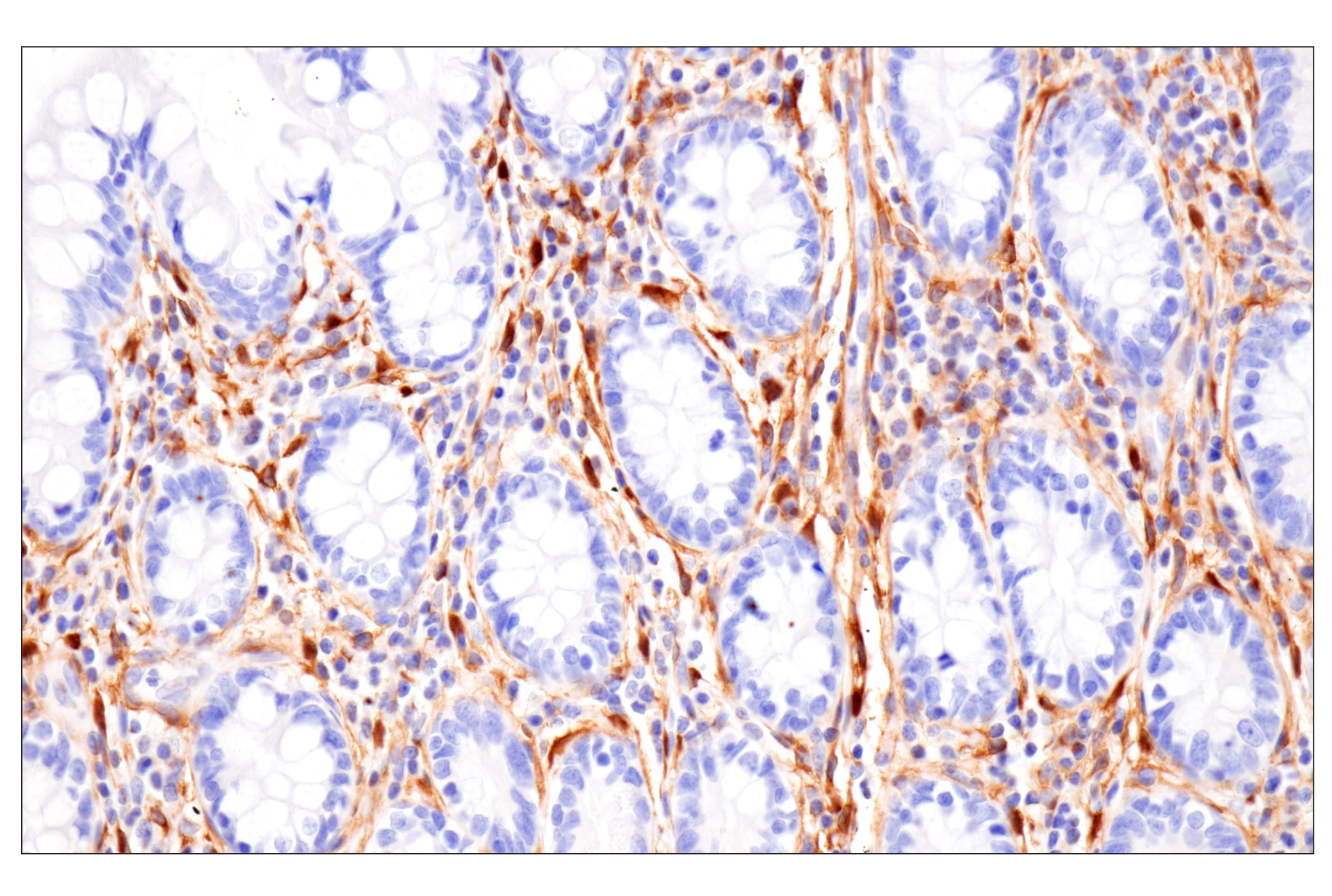 Immunohistochemistry Image 9: PPP1R14A/CPI-17 (F1I6X) Rabbit Monoclonal Antibody