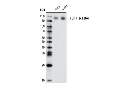 Western Blotting Image 1: EGF Receptor (D38B1) XP® Rabbit mAb (Biotinylated)