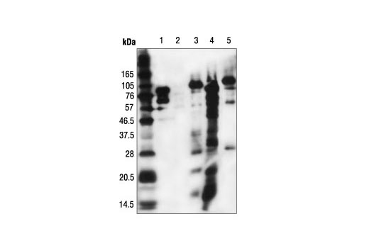 Western Blotting Image 2: Acetylated-Lysine (Ac-K-103) Mouse mAb (BSA and Azide Free)