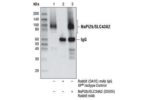 Immunoprecipitation Image 1: NaPi2b/SLC34A2 (D3V3I) Rabbit mAb