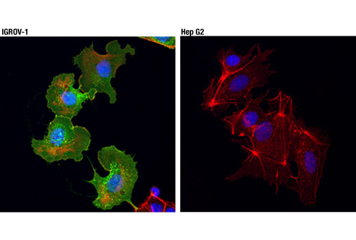 Immunofluorescence Image 1: NaPi2b/SLC34A2 (D3V3I) Rabbit mAb