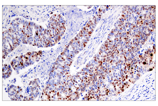 Immunohistochemistry Image 2: Cyclin D1 (E3P5S) XP® Rabbit mAb (BSA and Azide Free)