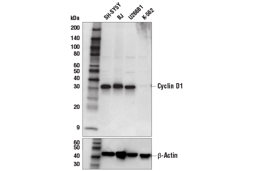 Western Blotting Image 1: Cyclin D1 (E3P5S) XP® Rabbit mAb (BSA and Azide Free)