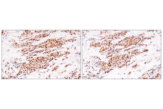 Immunohistochemistry Image 6: Cyclin D1 (E3P5S) XP® Rabbit mAb (BSA and Azide Free)