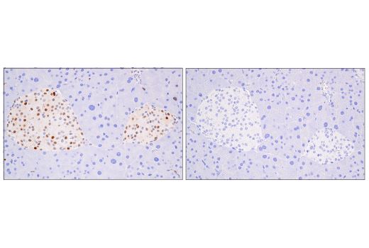 Immunohistochemistry Image 7: Cyclin D1 (E3P5S) XP® Rabbit mAb (BSA and Azide Free)