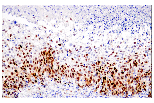 Immunohistochemistry Image 3: Cyclin D1 (E3P5S) XP® Rabbit mAb (BSA and Azide Free)