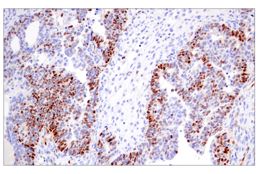 Immunohistochemistry Image 4: Cyclin D1 (E3P5S) XP® Rabbit mAb (BSA and Azide Free)