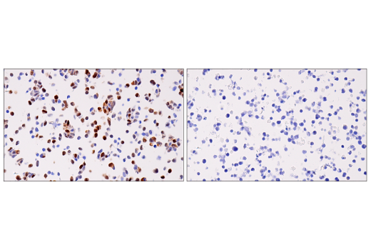 Immunohistochemistry Image 8: Cyclin D1 (E3P5S) XP® Rabbit mAb (BSA and Azide Free)