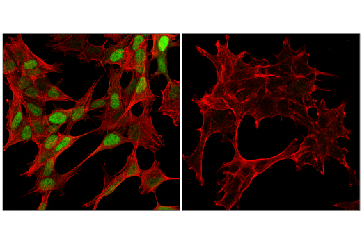 Immunofluorescence Image 1: Cyclin D1 (E3P5S) XP® Rabbit mAb (BSA and Azide Free)